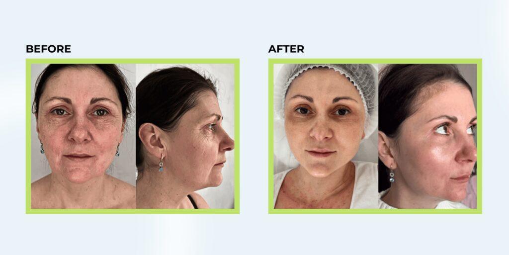 before&after