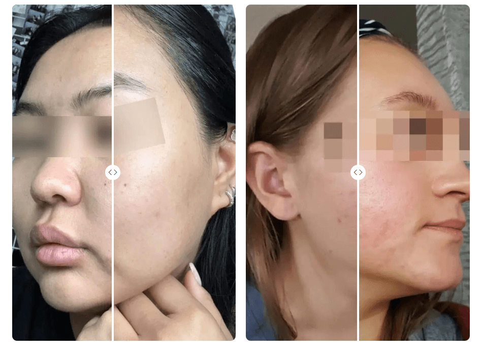 before&after