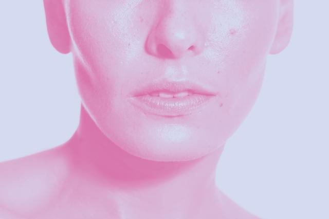 Dryness, excessive oiliness, or disruption of the skin microbiome